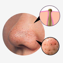 Instant Blackhead Removal Facial Mask (50% OFF)